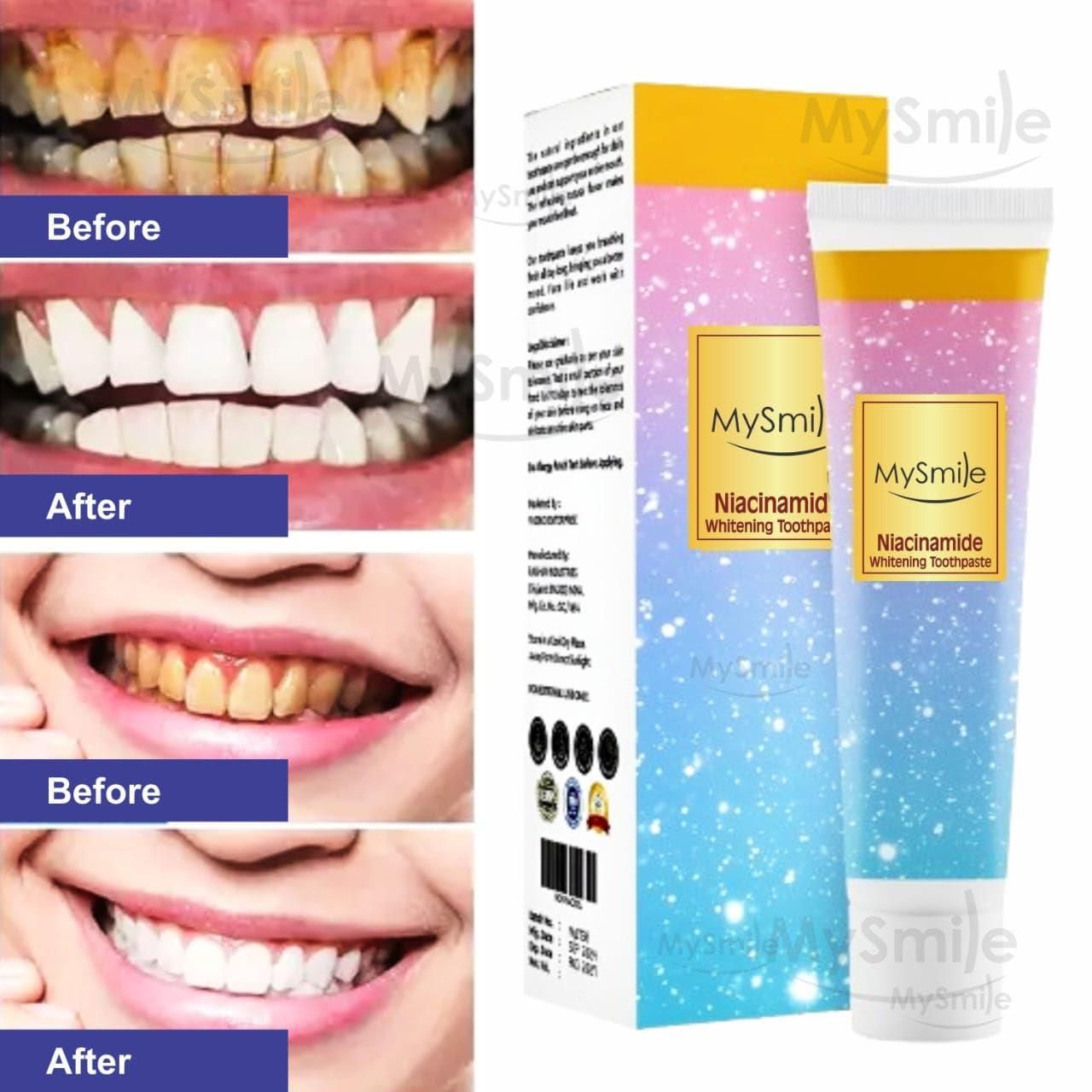 Niacinamide Whitening Toothpaste – Stain Removal & Fresh Breath (50g)